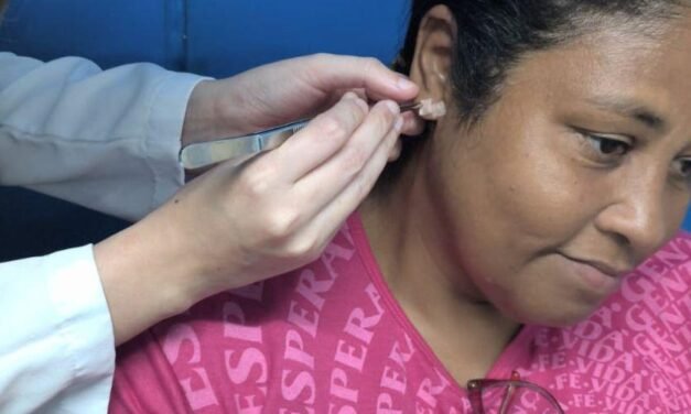 Unidade de Saúde inicia grupo de auriculoterapia