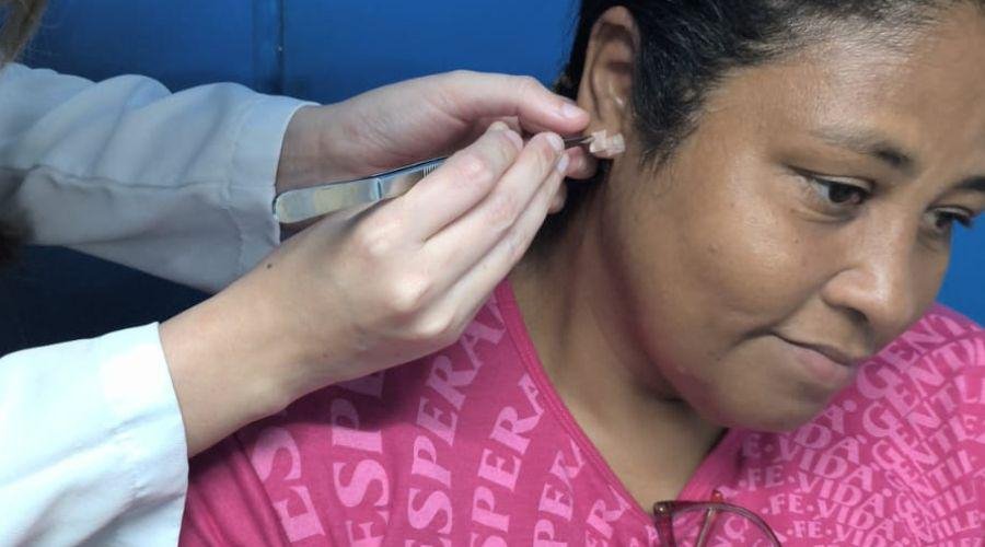 Unidade de Saúde inicia grupo de auriculoterapia