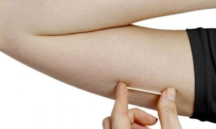 Implanon passa a oferecer proteção contraceptiva por até cinco anos