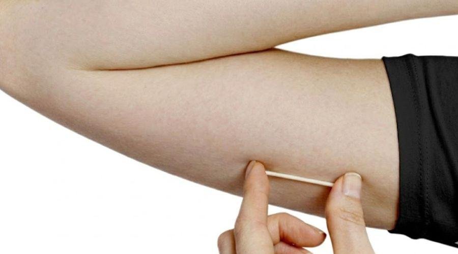Implanon passa a oferecer proteção contraceptiva por até cinco anos